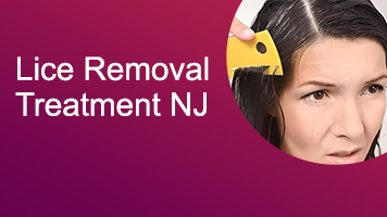 LICE REMOVAL TREATMENT NJ